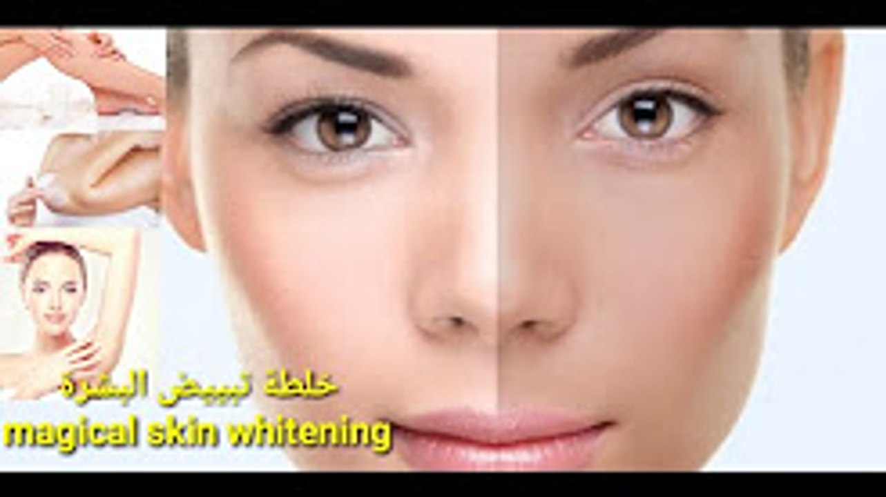 خلطة سحرية تبييض البشره مضمونة 100% magical skin whitening