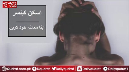 skin-cancer-self-examination must watch