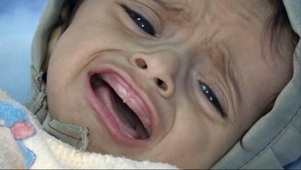 Dengue fever, malaria worsen Yemen humanitarian crisis