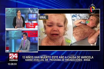 Sepa qué síntomas presenta la varicela y cómo tratarla