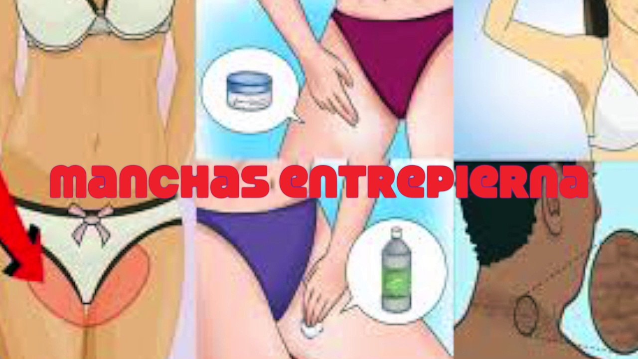 Blanquear la entrepierna en 10 min / remedio casero, muy fácil de hacer