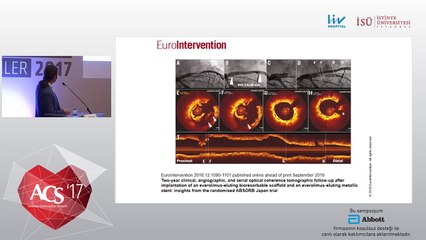 BVS'ler ile ilgili güncelleme - Dr. Ahmet Taştan