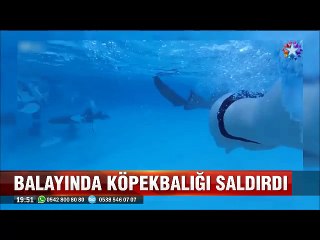 Balayı tatilindeki genç kadına Köpekbalığı böyle saldırdı