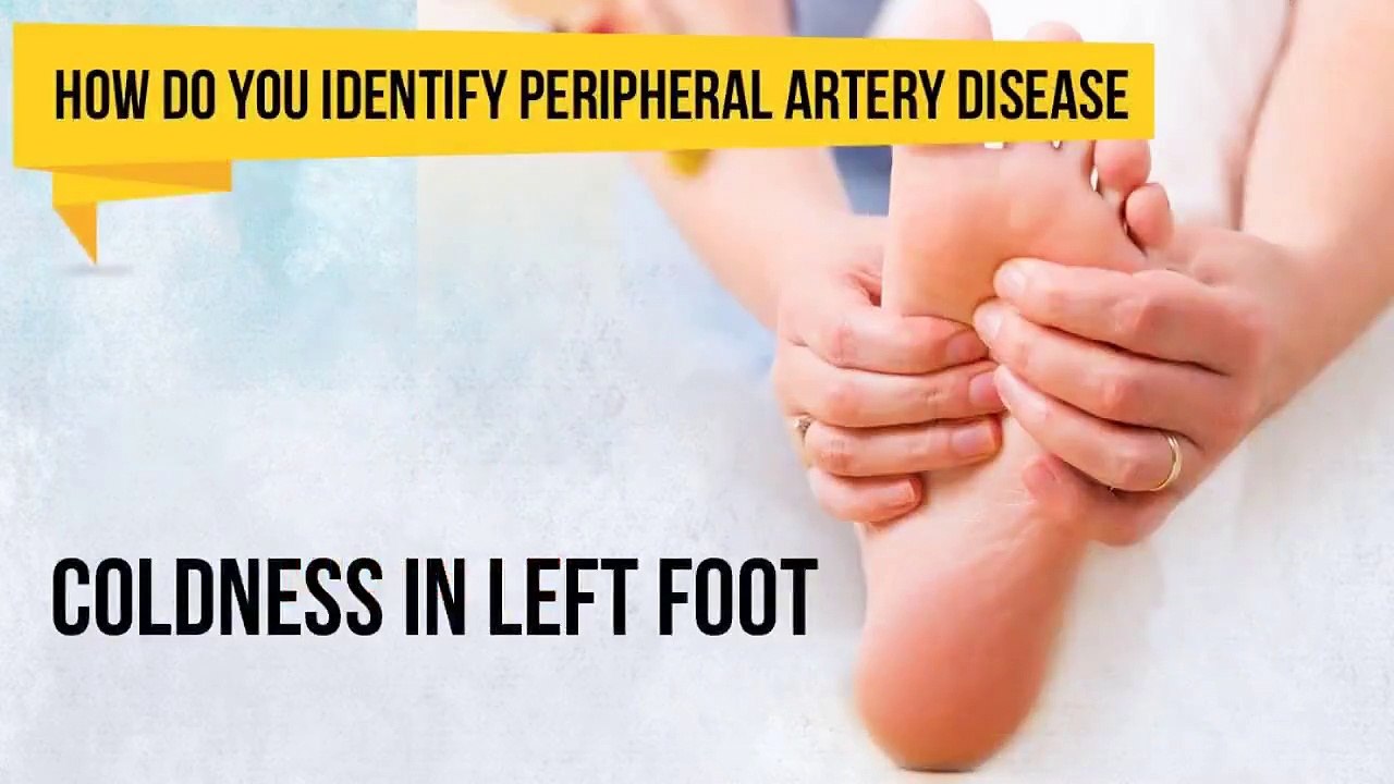 Peripheral artery disease