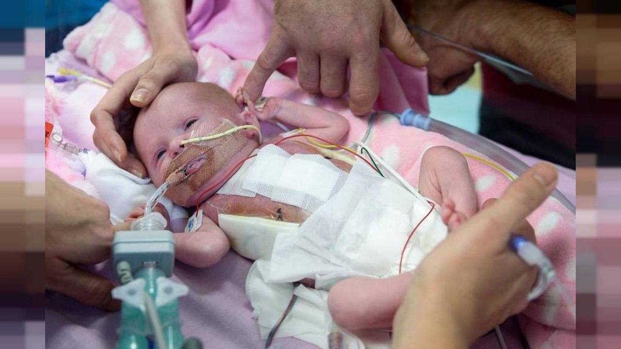 Ein Wunder: Außerhalb schlagendes Babyherz in Brustkorb operiert