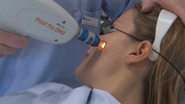 Bye bye a las cicatrices del acné