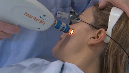 "Bye bye" a las cicatrices del acné