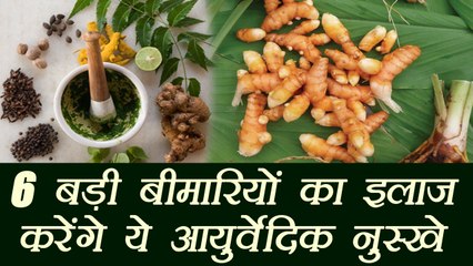 6 बड़ी बीमारियों का इलाज करेंगे ये आयुर्वेदिक नुस्खे, Ayurvedic remedies for 6 diseases | Boldsky