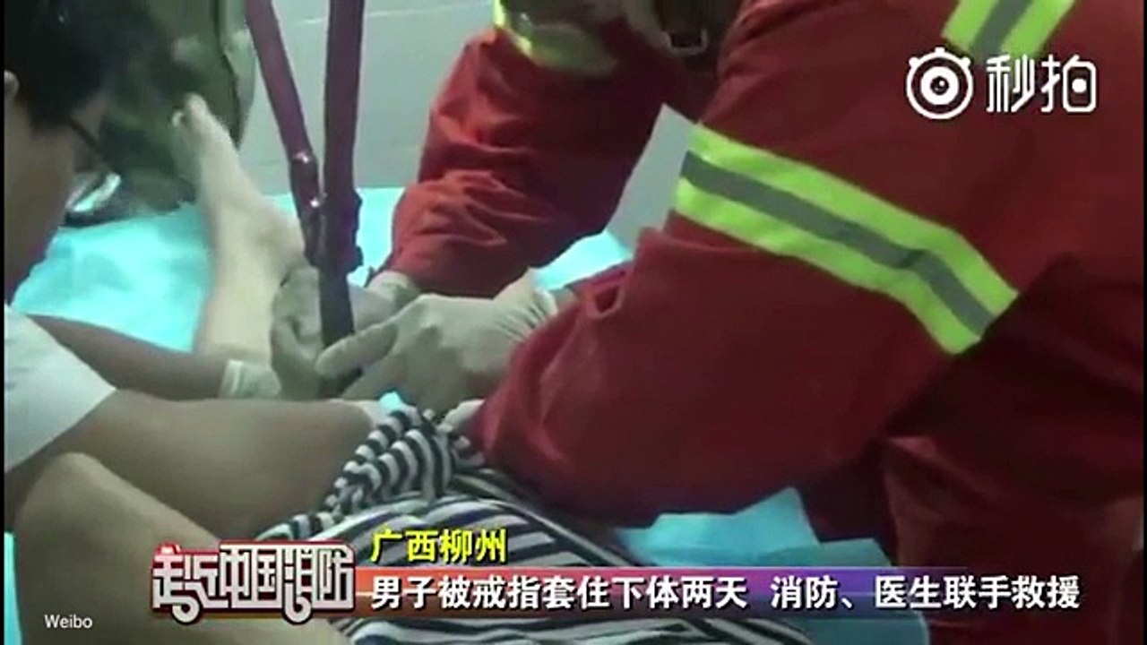 Chàng trai 18 tuổi bị kẹt "của quý" trong chiếc nhẫn suốt 2 ngày trời