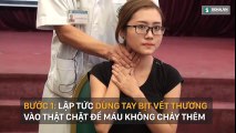 Hướng dẫn chính xác các bước sơ cứu khi bị cắt đứt mạch máu