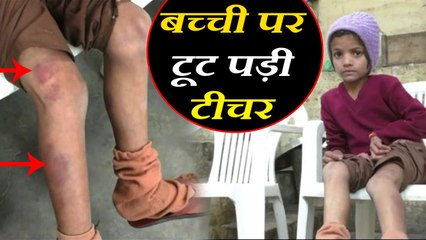 teacher beaten 7 yr old girl in hapur सात साल की बच्ची पर कहर बनकर टूट पड़ा टीचर, कर डाला ये हाल
