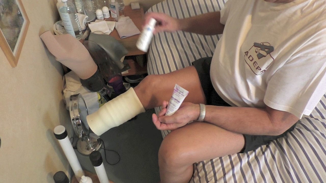 Chausser une prothèse tibiale