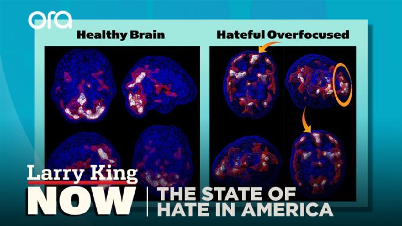 Inside "the brain on hate"
