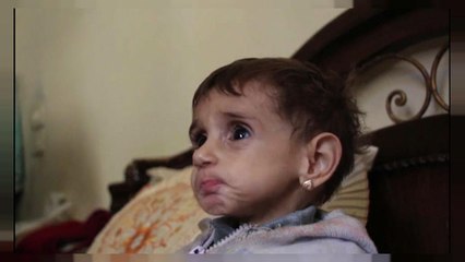 Suriye'de açlık krizi büyüyor