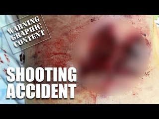 Shooting accidents - the insurance snap