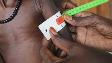 Sudán del Sur, una "tragedia" para los niños según Unicef