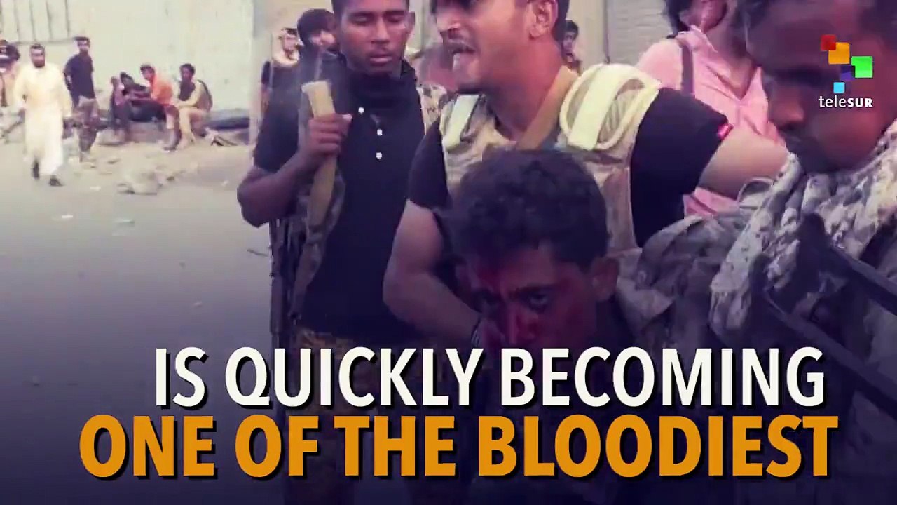 150 children die everyday in Yemen as Saudi Arabia