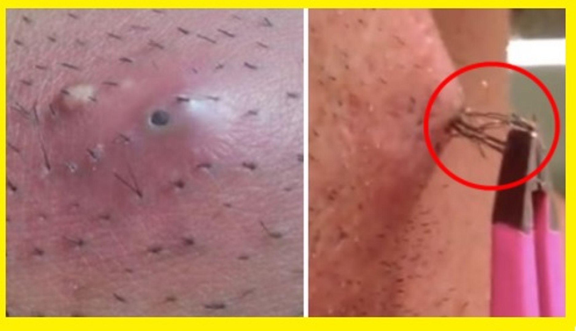 What Happens If You Never Shave Your Pubic Hair: Surprising Effects Revealed