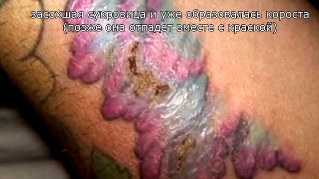 Как ухаживать за тату - ПРАВИЛЬНЫЙ УХОД-9kXdywQbyg8