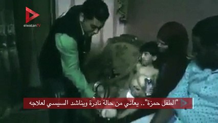 "الطفل حمزة".. يعاني من حالة نادرة ويناشد السيسي لعلاجه
