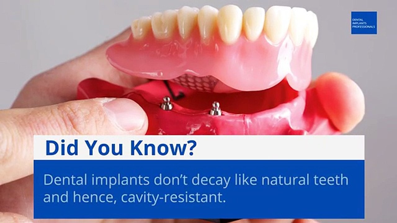 Dental Implants in Sydney – A Safe and Convenient Procedure