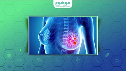 الأعراض المبكرة لسرطان الثدي