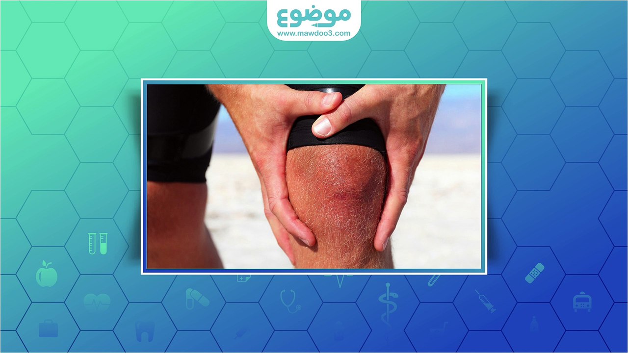 أسباب الام الركبة