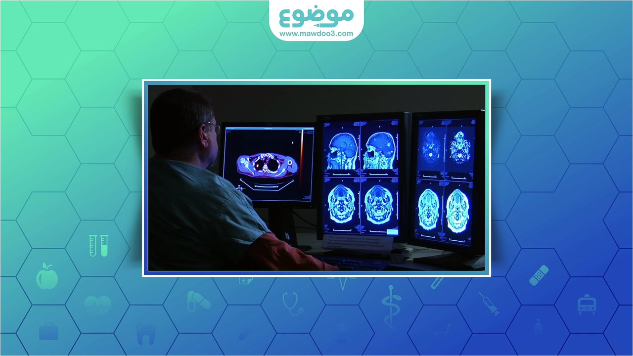 اعراض الجلطة الدماغية