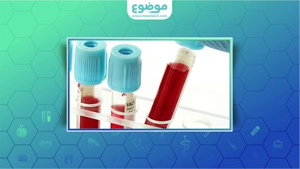 كيف أعرف اني حامل بولد او بنت بدون سونار