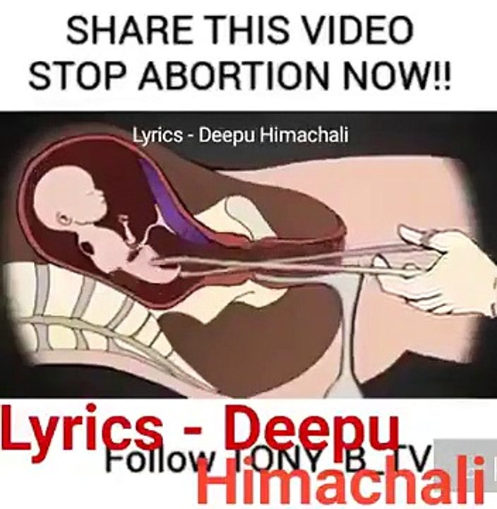 Share this abortion video... Stop abortion jldi...