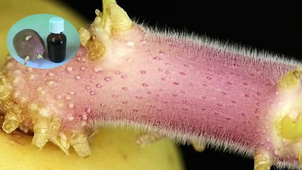 От болезней суставов, рака, катаракты помогут картофельные ростки