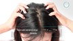 9 Highly Effective Solutions for Thinning Hair