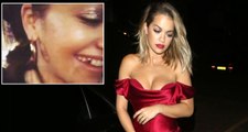 Şarkıcı Rita Ora, Taktırdığı Altın Dişleri Takipçilerine Gösterdi