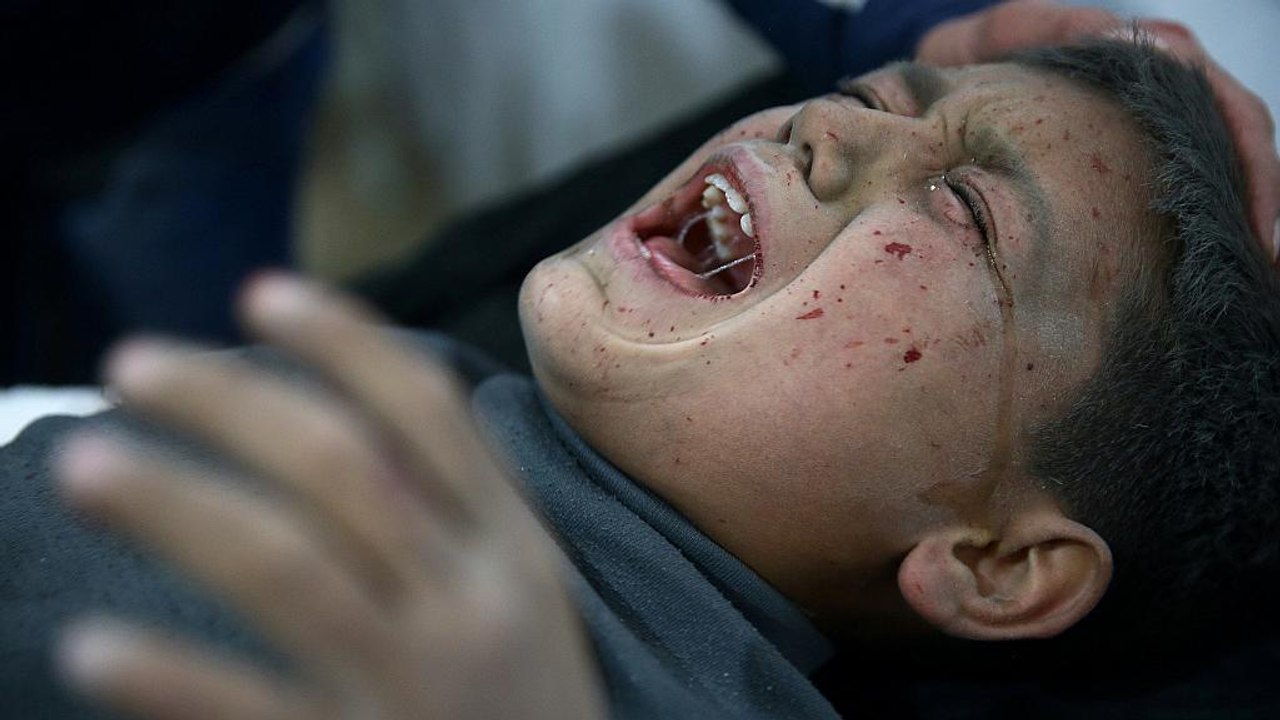 Sie brauchen dringend medizinische Hilfe: 500 aus belagerter Stadt in Syrien evakuiert