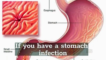 Norflox TZ Tablet - Uses  and Side Effects - YouTube (360p)