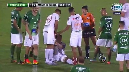 Un footballeur simule une crampe à la jambe… alors qu’il a une prothèse !