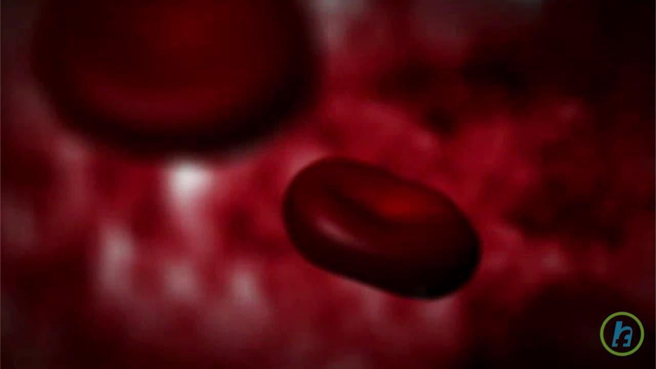 What is Myocardial Infarction?