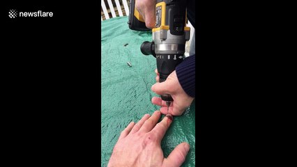 UK man drills finger wound to 'release pressure' after trapping it in door