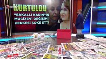 ''Sakallı Kadın''ın mucizevi değişimi, şoke etti!