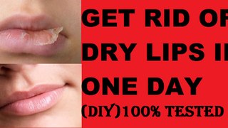 Dry Lips !! Winter Care Tips(DIY)LipCare