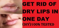 Dry Lips !! Winter Care Tips(DIY)LipCare