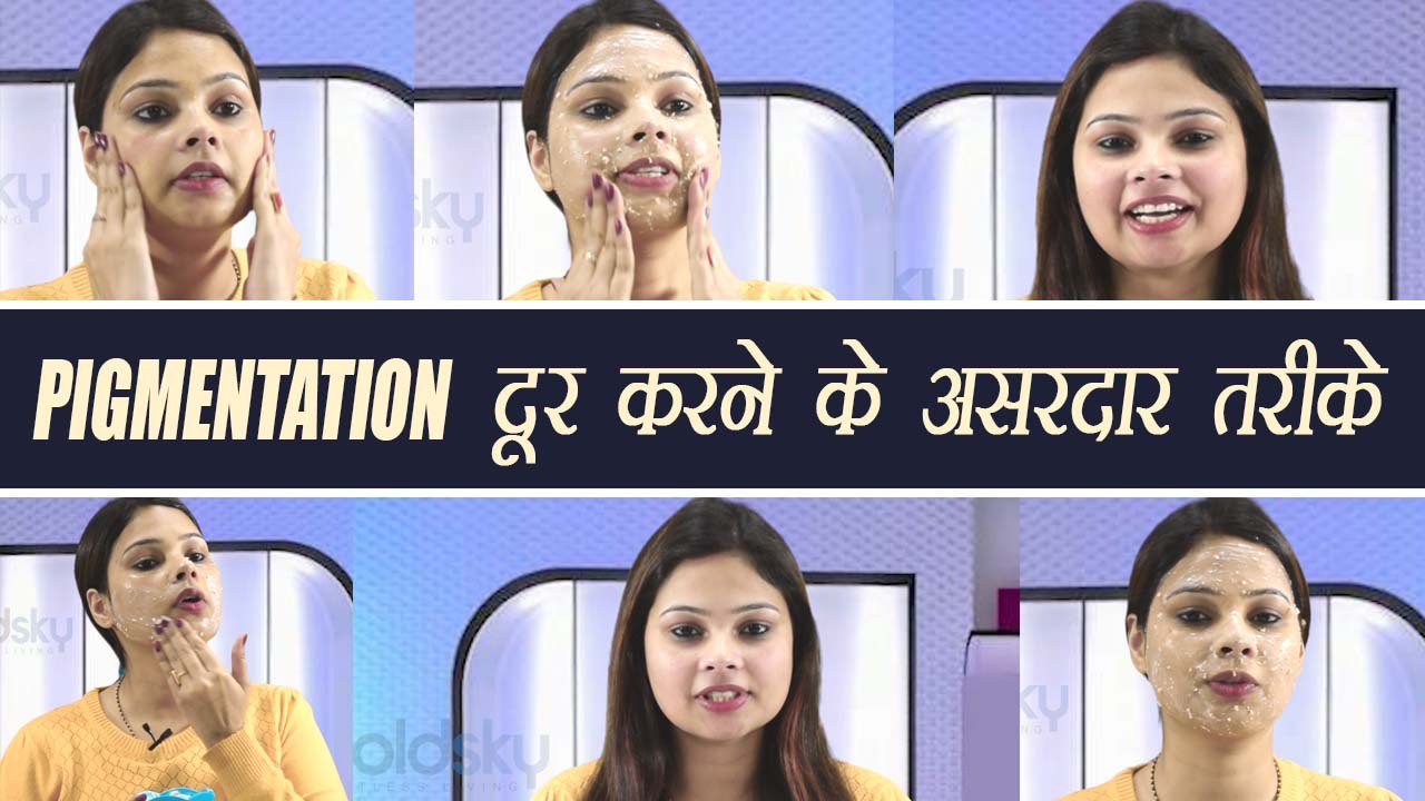 Pigmentation: झाइयां दूर करने के असरदार घरेलू तरीके | DIY | Boldsky