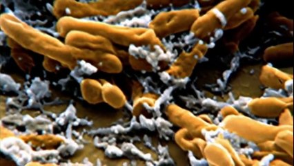 Evolution 4/7 - Evolutionary Arms Race part 1/2