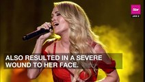 Carrie Underwood ‘Not Quite Looking The Same’ After ‘Freak Accident’