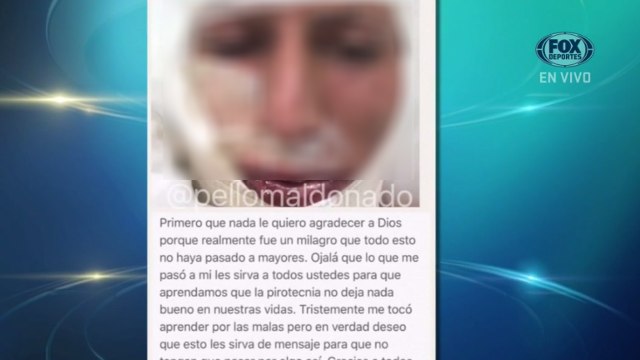 Central FOX: Breves del futbol mexicano