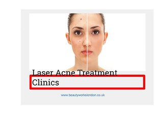 Best Laser Acne Treatment Clinics in London