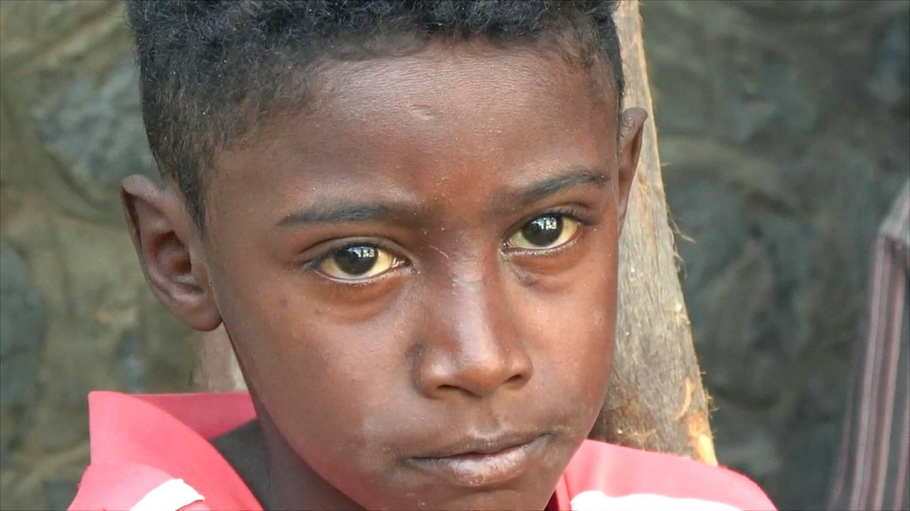 Yemenis say little has changed in Hodeidah despite aid