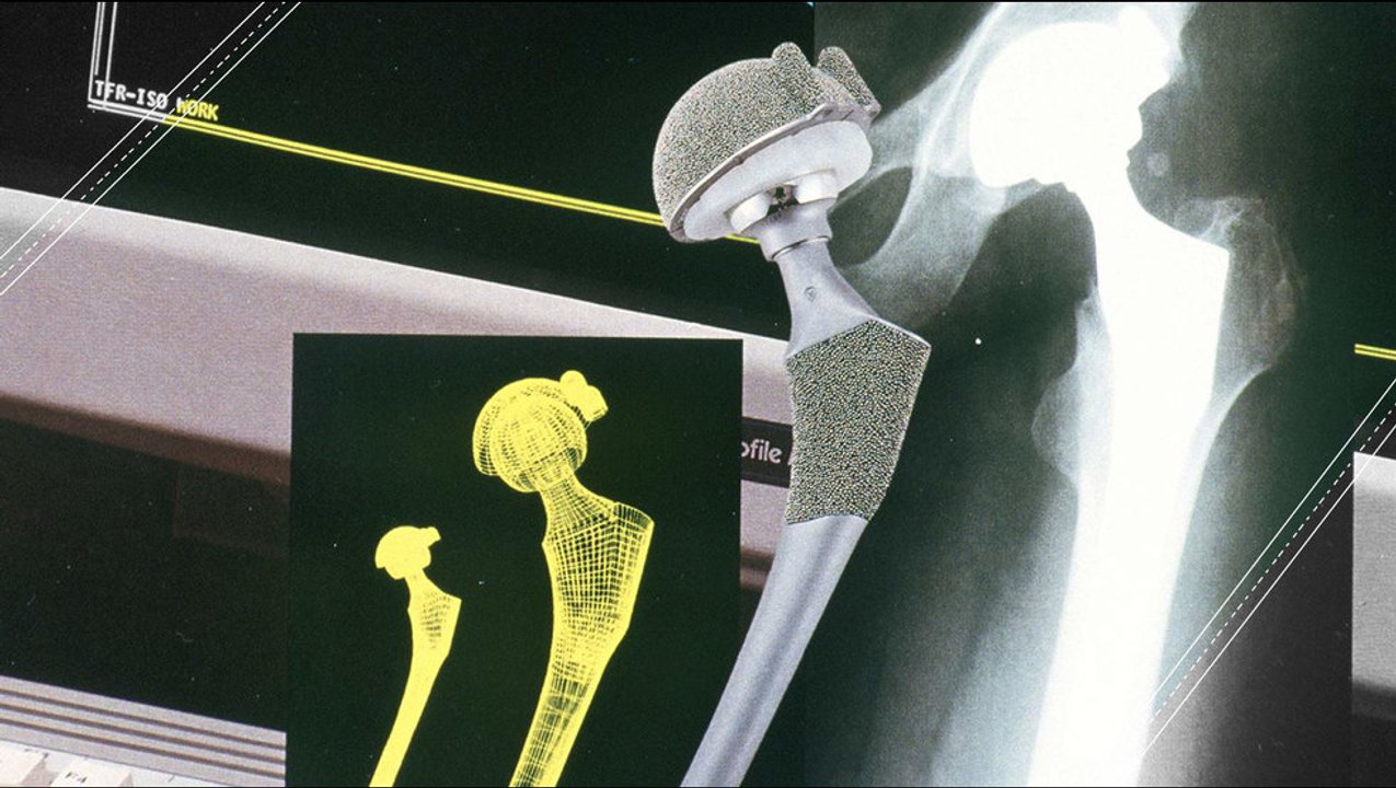 Bone Regeneration Is Possible Now