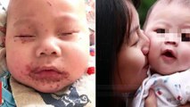 Bayi tertular herpes, ibu imbau orangtua untuk berhati-hati cium bayi - TomoNews