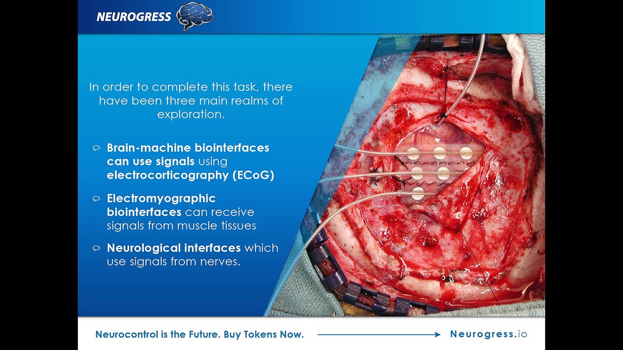 Would you like to be a Cyborg?